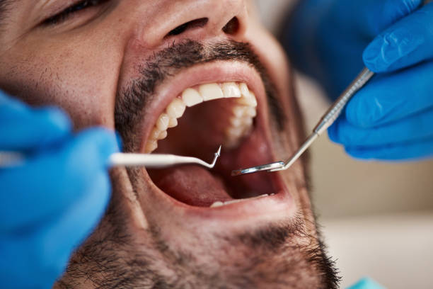 Best Emergency Dental Services for Seniors in Bonnetsville, NC